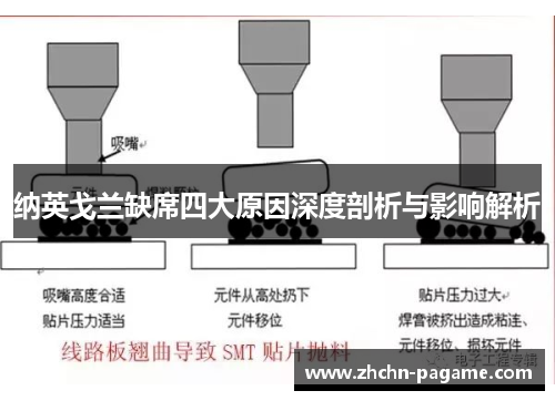 纳英戈兰缺席四大原因深度剖析与影响解析 纳英戈兰缺席四大原因深度剖析与影响解析